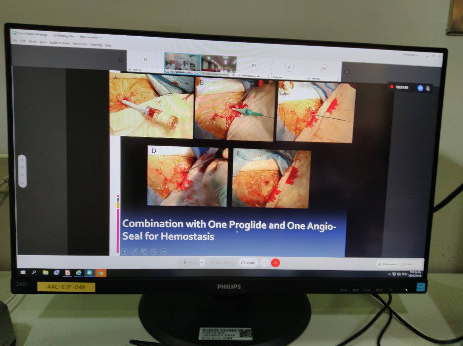 몽골과 대만 의사들이 온라인으로 심혈관 치료 경험을 교환.jpg