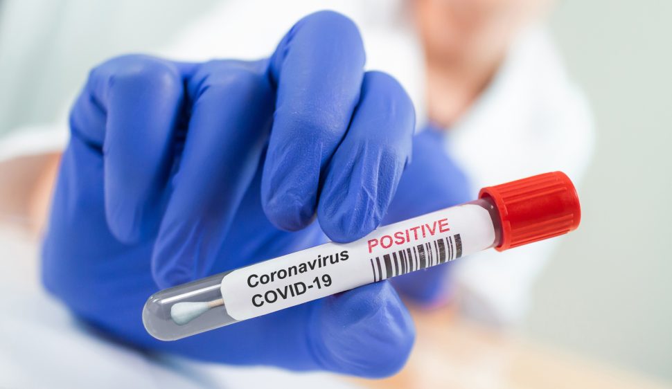 어제 하루 동안 785명이 코로나바이러스 신규 감염자로 등록되었으며, 4명 사망하여.jpg