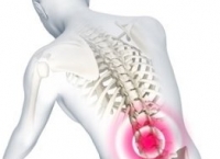허리 '삐끗'하여 생긴 통증은 허리 디스크?